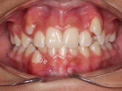 before Image