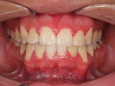 after Image