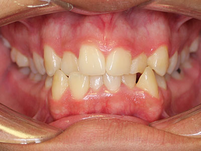 before Image